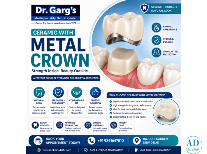 Ceramic with Metal Crown Treatment | Dr. Garg’s Dental Center