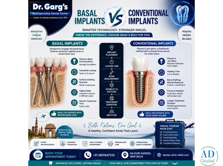 Basal Implants vs Conventional Implants: Complete Guide | Dr. Garg’s Multispeciality Dental Center