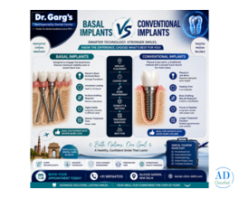 Basal Implants vs Conventional Implants: Complete Guide | Dr. Garg’s Multispeciality Dental Center