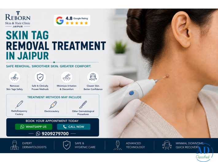 Skin Tag Removal Treatment in Jaipur for Visible Skin Growths