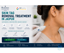 Skin Tag Removal Treatment in Jaipur for Visible Skin Growths