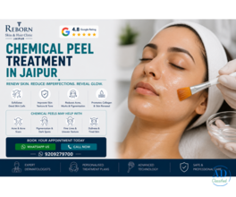 Chemical Peeling Treatment in Jaipur for Acne Marks
