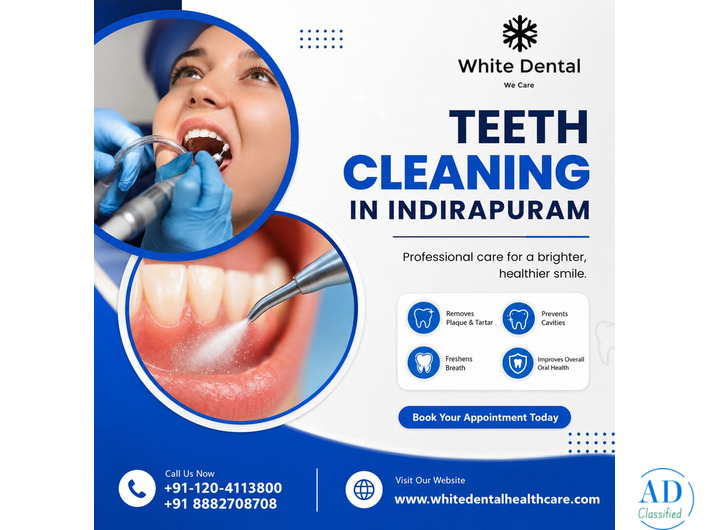 Teeth Cleaning in Indirapuram for a Healthy Smile