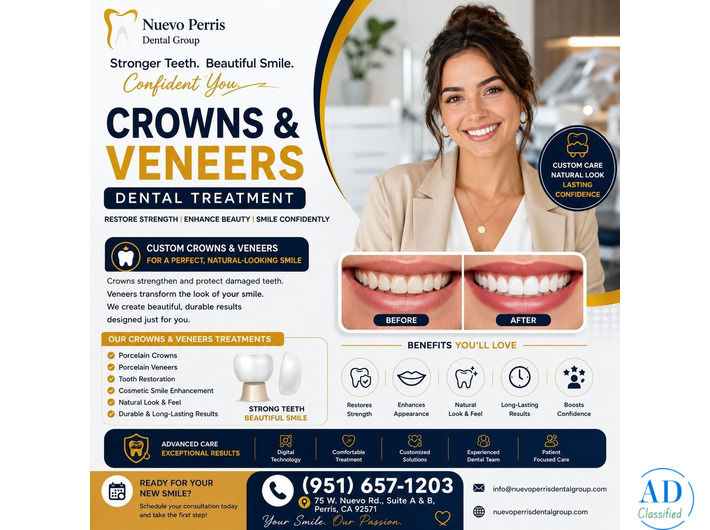 Crowns & Veneers Dental Treatment in Menifee | Nuevo
