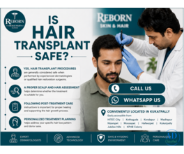 Hair Loss Getting Noticeable? Explore Hair Transplant in Banjara Hills
