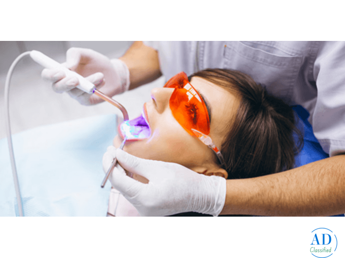 Professional Teeth Whitening in Ludhiana at Forever Smiles Dental Clinic