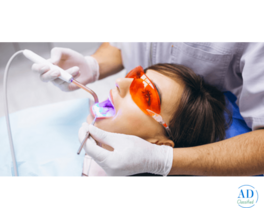Professional Teeth Whitening in Ludhiana at Forever Smiles Dental Clinic