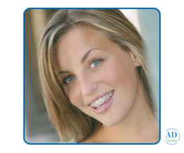 Best Tooth Replacement in Tustin, California | Ginnie Chen DDS