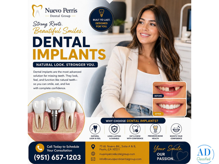 Dental Implants Treatment in Perris | Nuevo Perris Dental