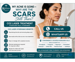 Explore CO2 Laser Treatment in Banjara Hills, Hyderabad