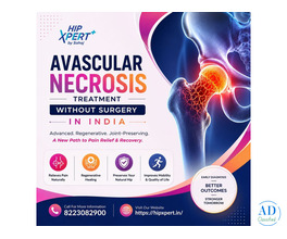 Avascular Necrosis Treatment Without Surgery in India - Hip Xpert