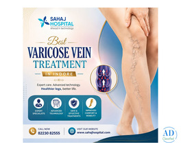 Best Varicose Vein Treatment in Indore - Sahaj Hospital