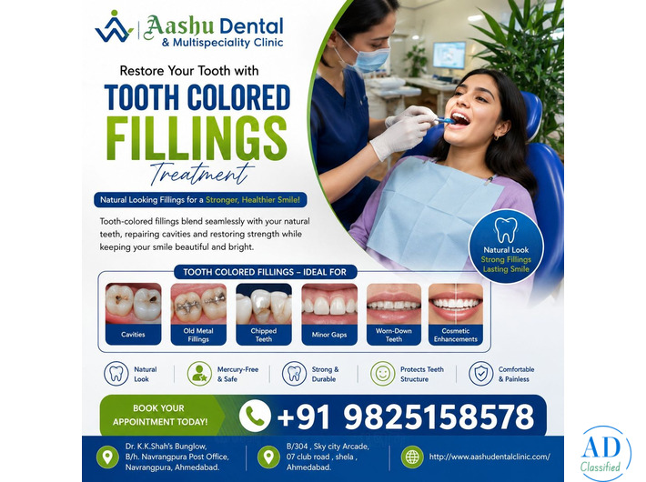 Expert Tooth Colored Fillings Treatment | DR. Manish Shah
