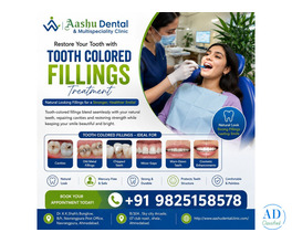 Expert Tooth Colored Fillings Treatment | DR. Manish Shah