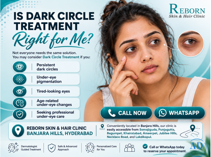 Under-Eye Pigmentation & Dark Circle Treatment in Banjara Hills