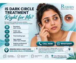 Under-Eye Pigmentation & Dark Circle Treatment in Banjara Hills