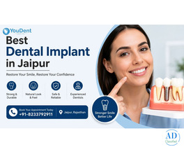 Best Dental Implant in Jaipur – Get Your Perfect Smile Today!